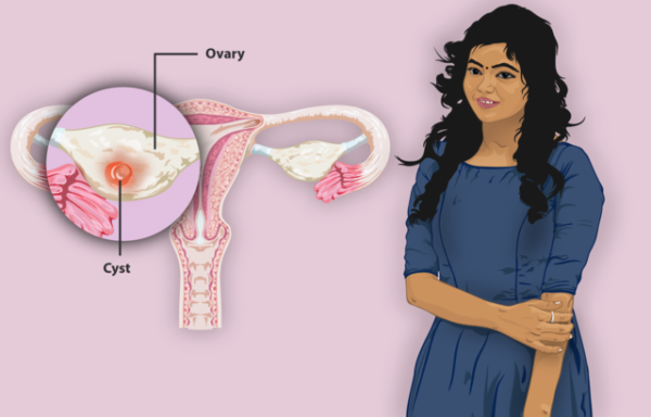 卵巣嚢胞スピリチュアルな意味と性格