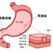 胃潰瘍スピリチュアルな意味と性格